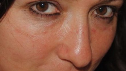 Özlem Erben